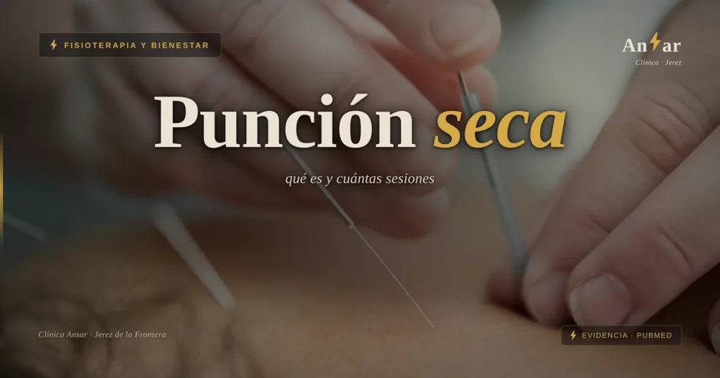 Punción seca: para qué sirve, qué duele y cuántas sesiones se necesitan — Clínica Ansar, fisioterapia en Jerez de la Frontera