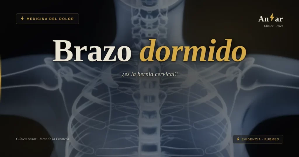 Brazo dormido y hormigueo: ¿hernia cervical? — Clínica Ansar, fisioterapia en Jerez de la Frontera